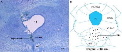 α-1 Adrenoceptor Activation in the Dorsal Raphe Nucleus Decreases Food Intake in Fasted Rats